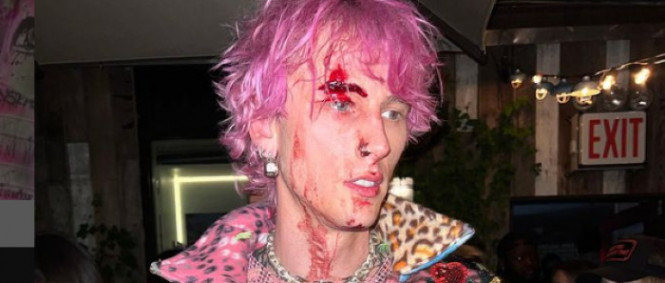 Machine Gun Kelly si na party rozmlátil skleničku o hlavu. Oslavoval tak vyprodaný koncert