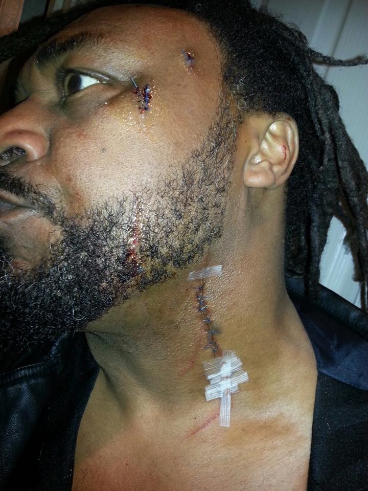 Benji Webbe attack